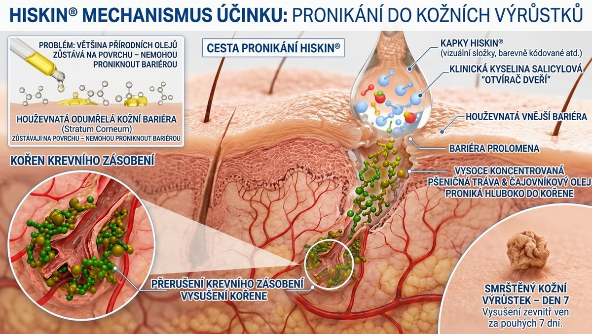 𝐇𝐢𝐬𝐤𝐢𝐧® 2-in-1 Pokročilý bezbolestný krém pro péči o pokožku bez viditelných stop – pro kožní výrůstky, bradavice a viditelné nedokonalosti pokožky