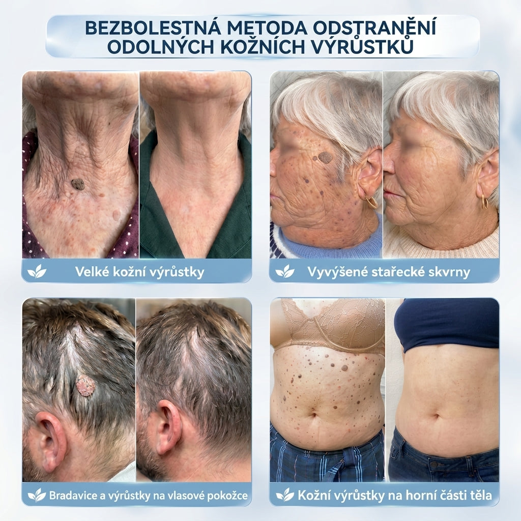 𝐇𝐢𝐬𝐤𝐢𝐧® 2-in-1 Pokročilý bezbolestný krém pro péči o pokožku bez viditelných stop – pro kožní výrůstky, bradavice a viditelné nedokonalosti pokožky